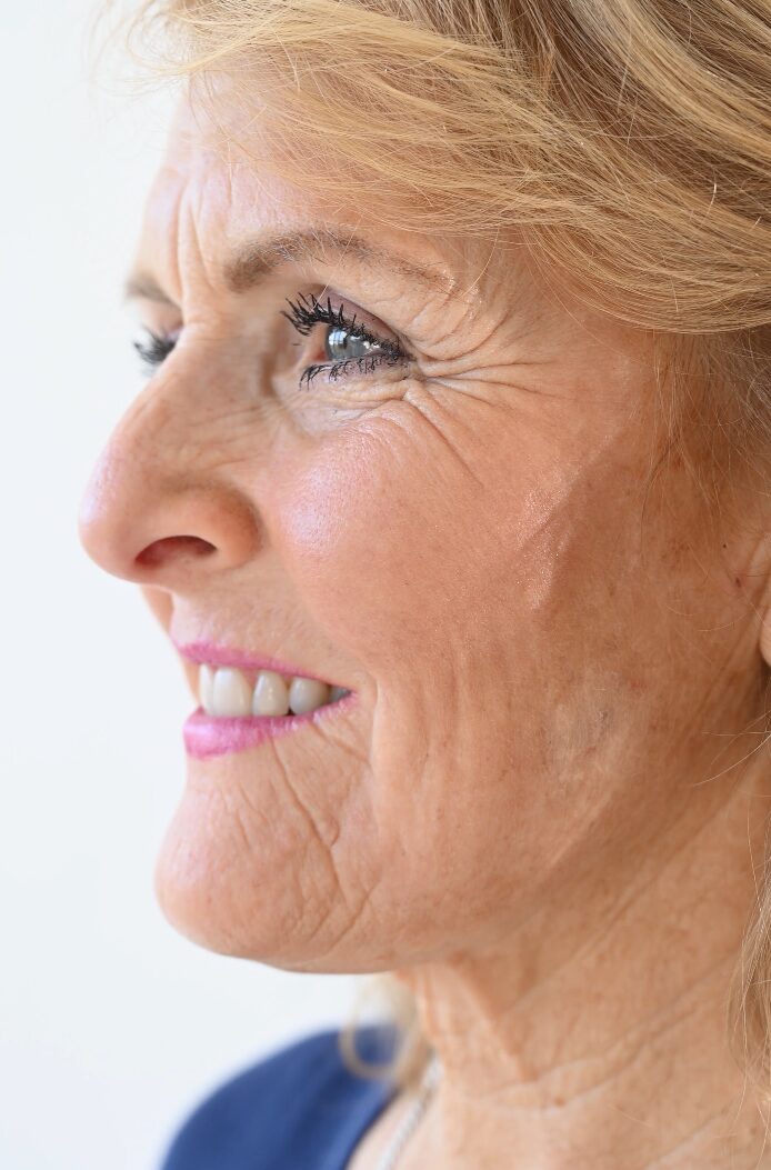 Seniorin mit Zahnprothese